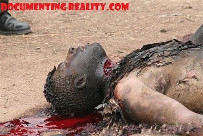 throat-slashed-burned-1.jpg