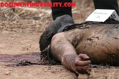 throat-slashed-burned-2.jpg