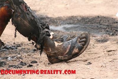 throat-slashed-burned-3.jpg