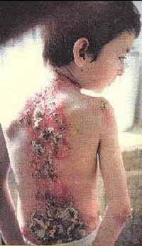 child-chechen.jpg