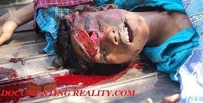 head-injury1.jpg