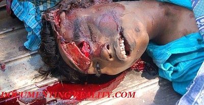 head-injury2.jpg