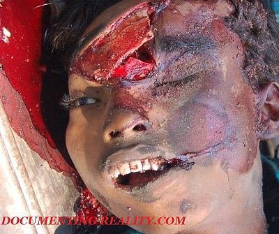 head-injury3.jpg
