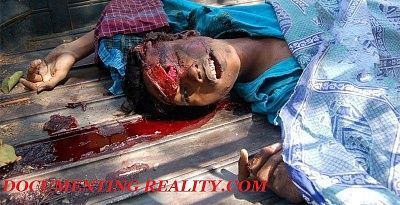 head-injury4.jpg