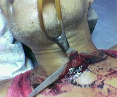 scissors-throat.jpg