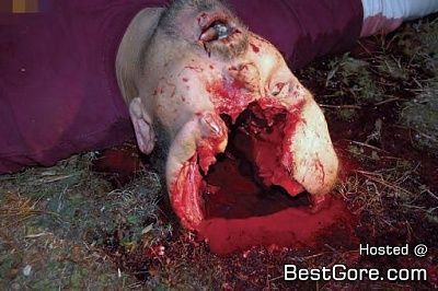 suicide-brain-feet-04.jpg