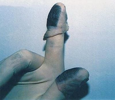dead-fingers.jpg