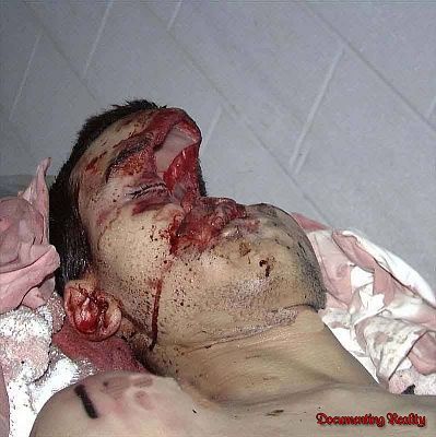 face-half-gone.jpg