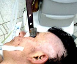 cuchillo-en-el-ojo-1.jpg