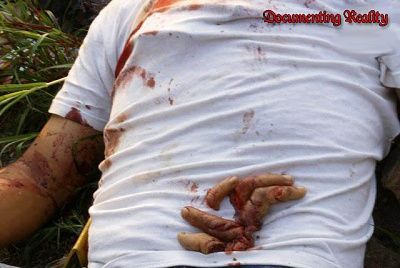 body-found-fingers-severed.jpg