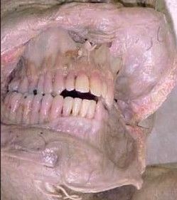 pink-teeth.jpg