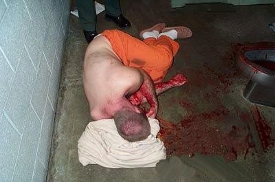 prison-wrist.jpg