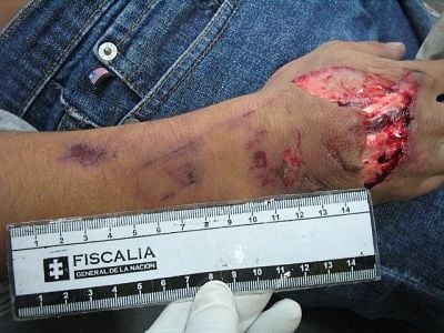 376008996_imagen087_123_554lo.jpg