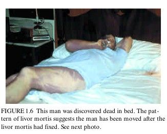 dead-bed.jpg