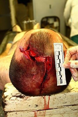 head-injury.jpg