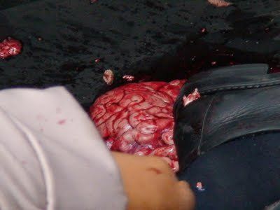 head is gone7.jpg