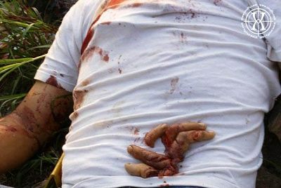 body-found-fingers-severed.jpg