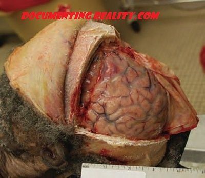 bunch-brains.jpg