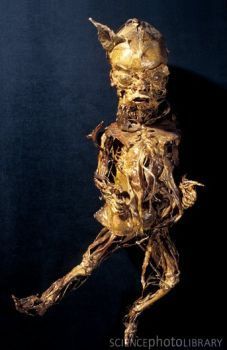 P6800931-Human_baby_anatomy,_Fragonard_Museum-SPL.jpg