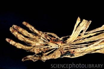 P8800174-Human_hand_anatomy,_Fragonard_Museum-SPL.jpg