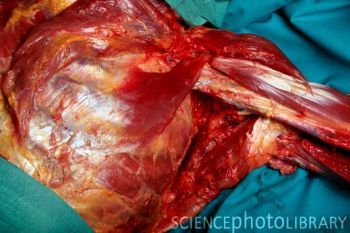 M8760117-Dissected_corpse-SPL.jpg