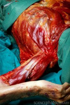 M8760118-Dissected_corpse-SPL.jpg