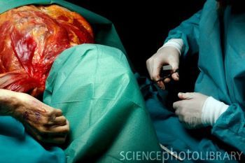M8760119-Autopsy_examination-SPL.jpg
