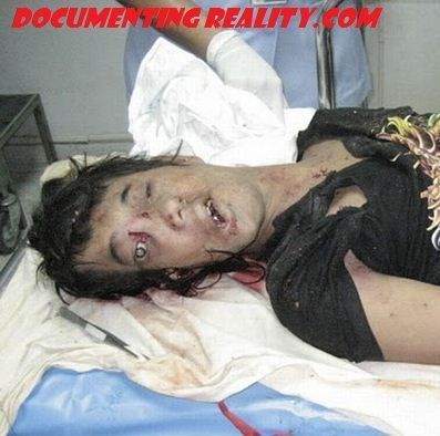 woman-head-crushed-bus.jpg