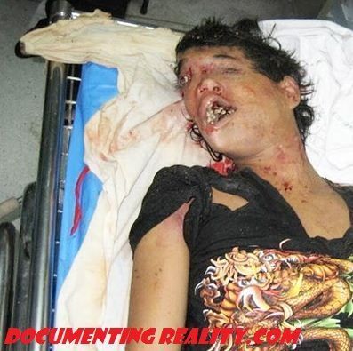 WOMAN HEAD CRUSHED BY BUS1.JPG