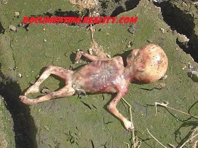 dead-fetus.jpg