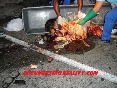 woman-bits-after-car-accident.jpeg