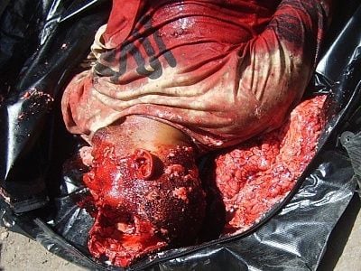 a1bloodbrainsblackbag.preview.jpg
