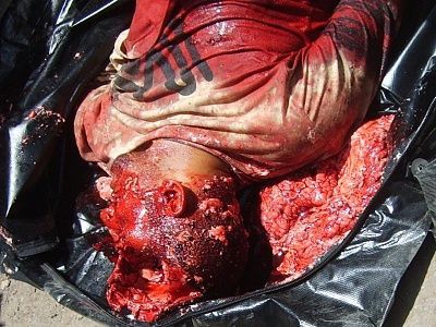 a1bloodbrainsblackbag.preview.jpg