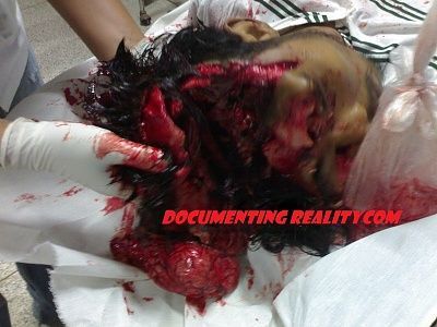 head-trauma1.jpg