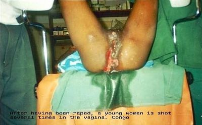shot-vagina.jpg