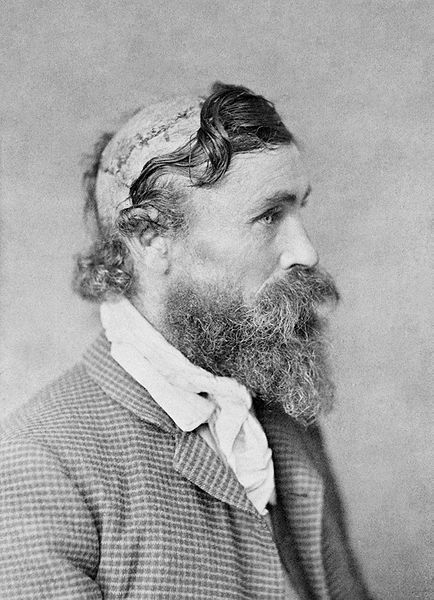 434px-Robert_McGee%2C_scalped_as_a_child_by_Sioux_Chief_Little_Turtle_in_1864-2.jpg
