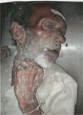 dead-body09.jpg