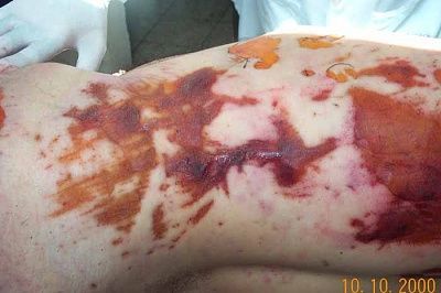 tortured7.jpg