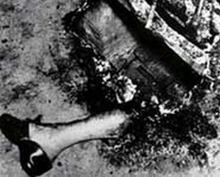 Spontaneous-Human-Combustion-Can-People-Suddenly-Burst-into-Flames-3.jpg