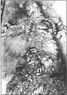 shc_heart_and_intestines.jpg