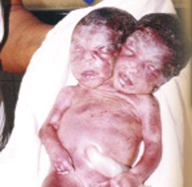 two_headed.jpg