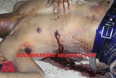 22-yo-shot-robbed-1-.jpg