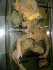 Name:  siriraj.jpg
Views: 3986
Size:  11.0 KB