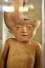 deformed-head.jpg