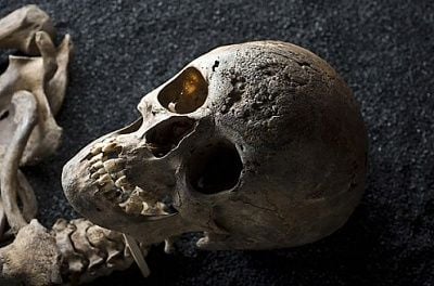 skelton.jpg