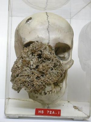 female-skull.jpg