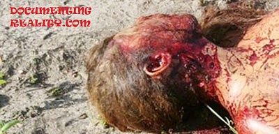stabbed-stoned-1-.jpg