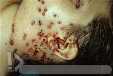Name:  31.jpg
Views: 43667
Size:  27.2 KB