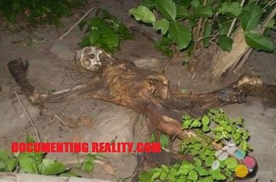 cadaver.jpg