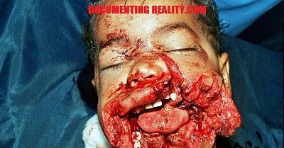 explosion-boy-face-1-.jpg